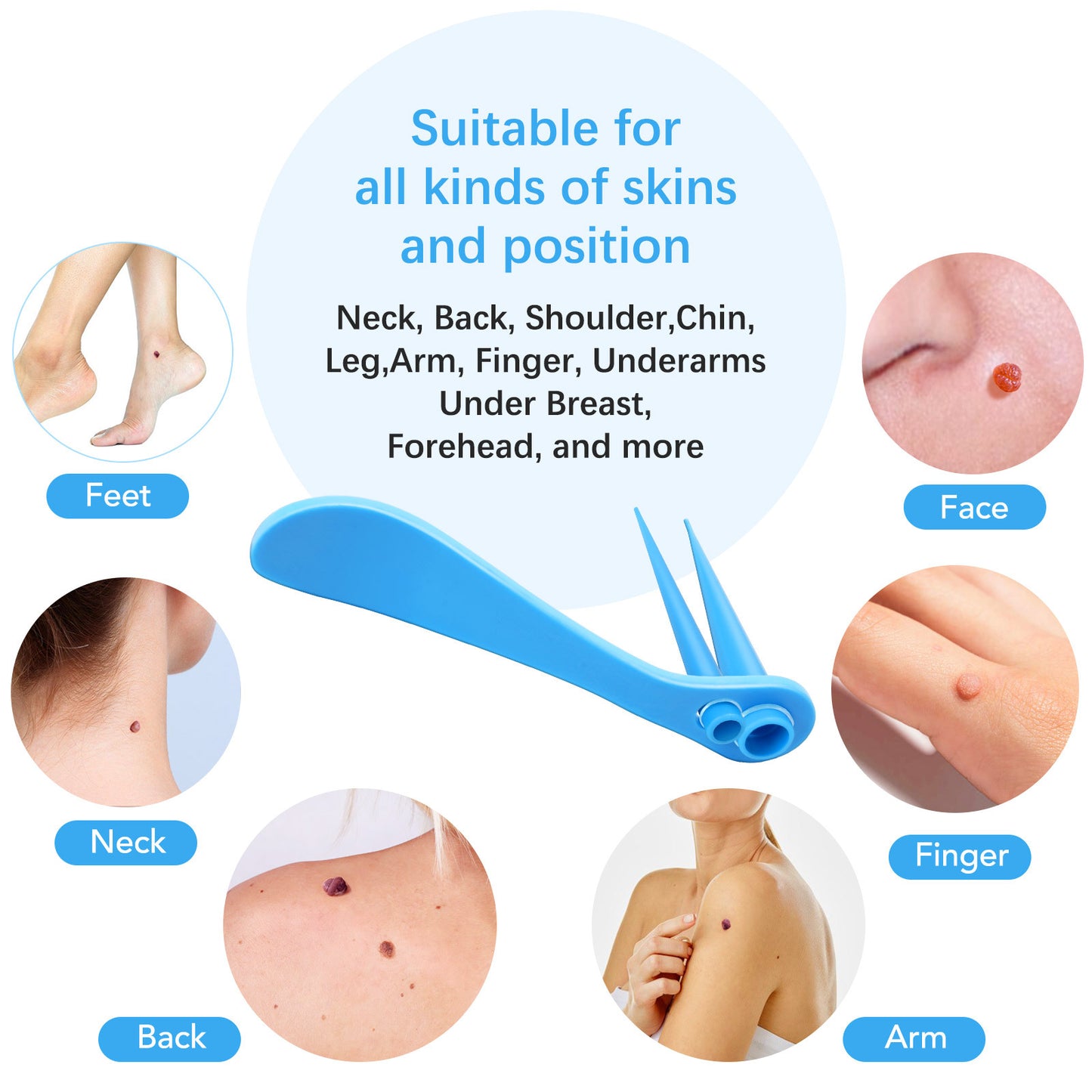 ELAIMEI - Skin Tag Removal Kit-2 in 1 -Painless and Easy Remover at Home