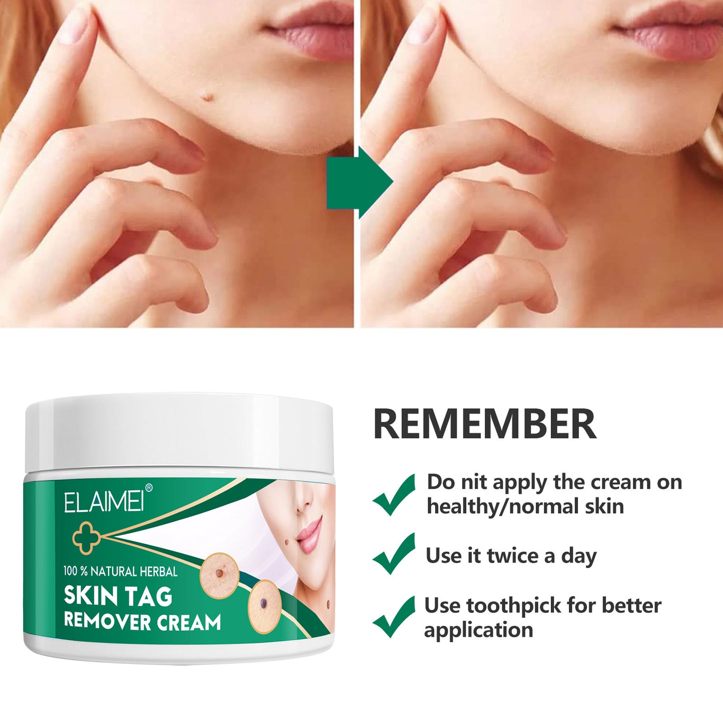 ELAIMEI - 100% Natural Herbal-Skin Tag Remover Cream-Safe-Painless and Reliable