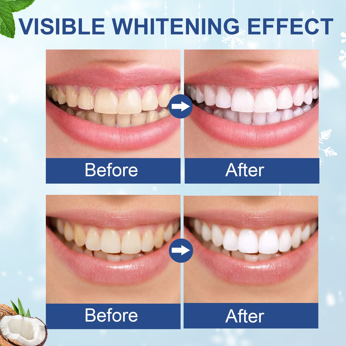 ELAIMEI - ELAIMEI Teeth Whitening Patch Tartar Cleaning Smoke Stain Removal