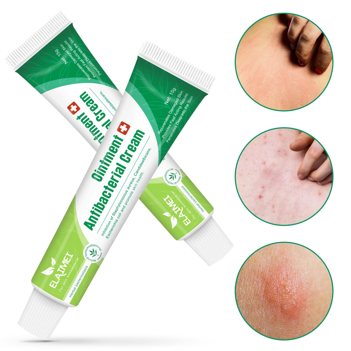 ELAIMEI - Ointment Antibacterial Cream for Skin Infection-Relieves Itchy Skin