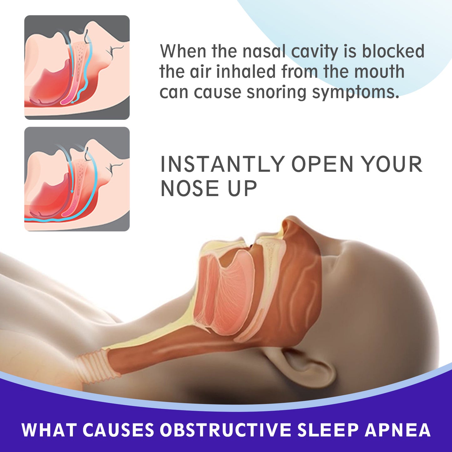 SEFUDUN - Nasal Strips - Reduce Snoring-Improves Breathing During Sleep