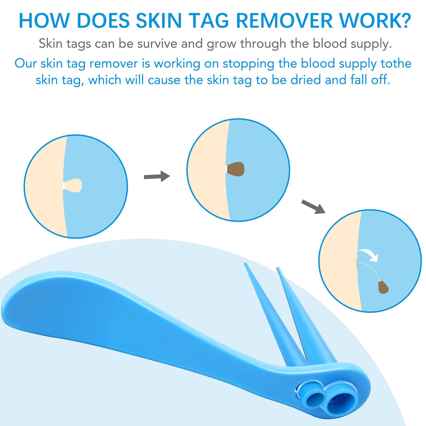 ELAIMEI - Skin Tag Removal Kit-2 in 1 -Painless and Easy Remover at Home