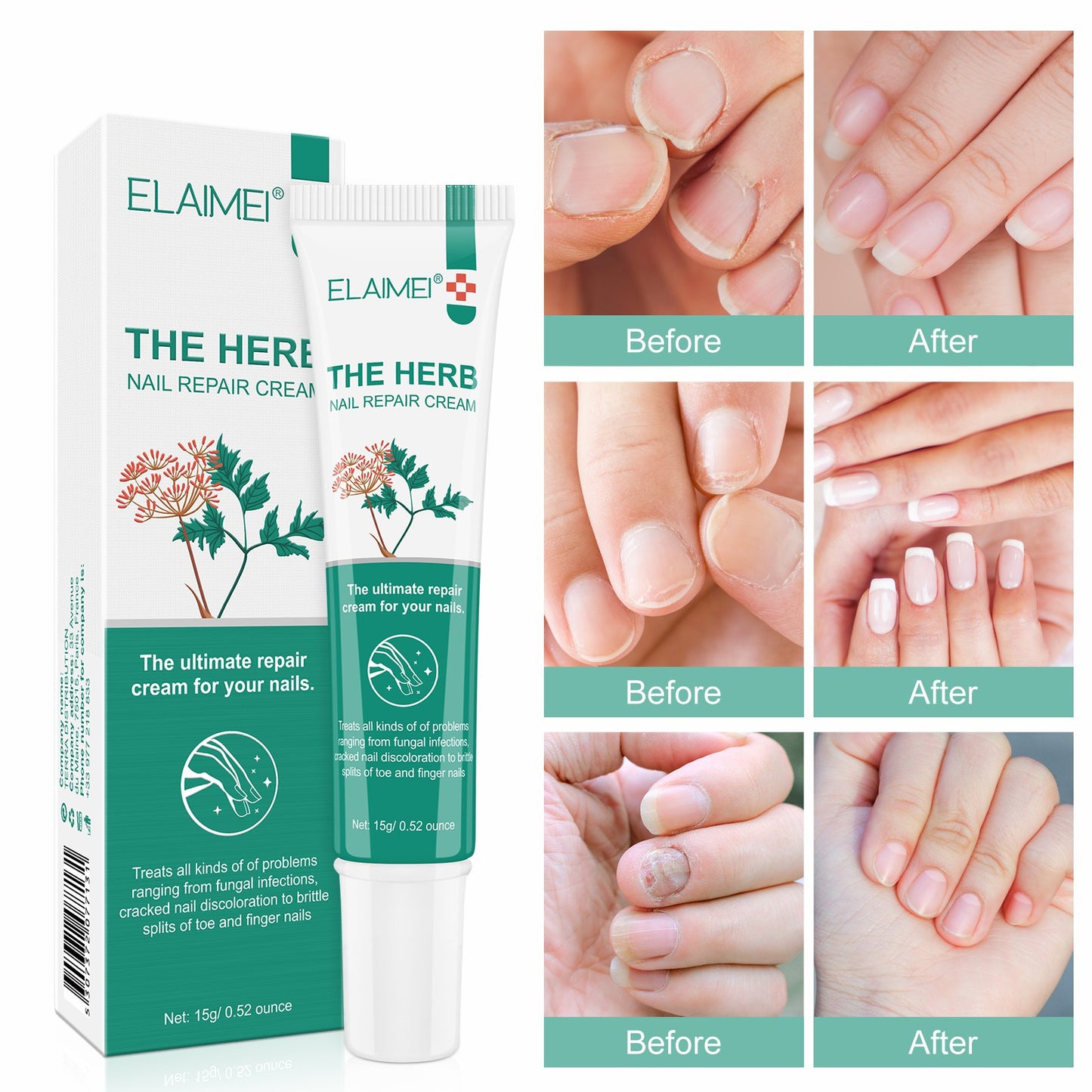 ELAIMEI - The Herb-Nail Repair Cream-Ultimate Repair Cream for Nails- Treat Nails