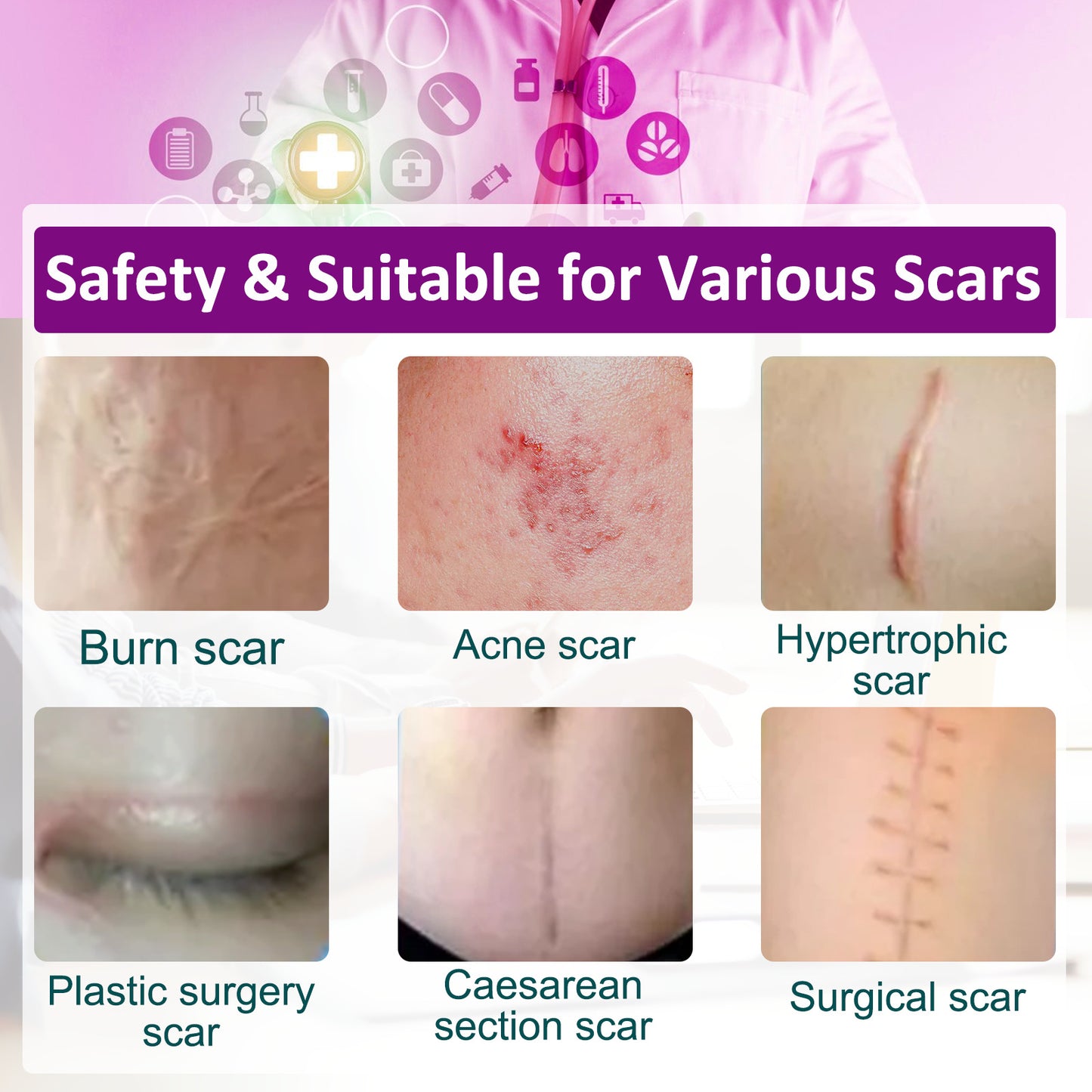 ELAIMEI- Clear Silicone Scar Sheets -Professional Scar Removal 4cm x 1.5m