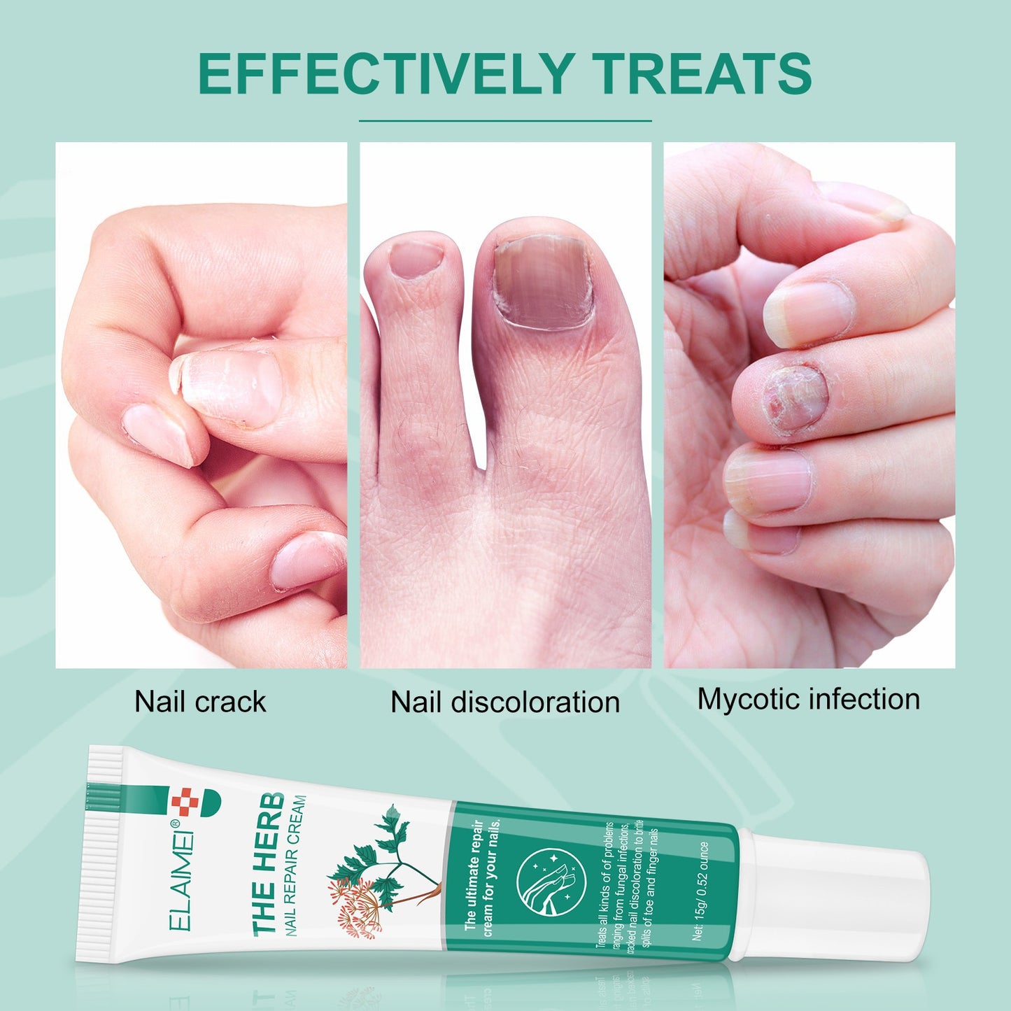 ELAIMEI - The Herb-Nail Repair Cream-Ultimate Repair Cream for Nails- Treat Nails