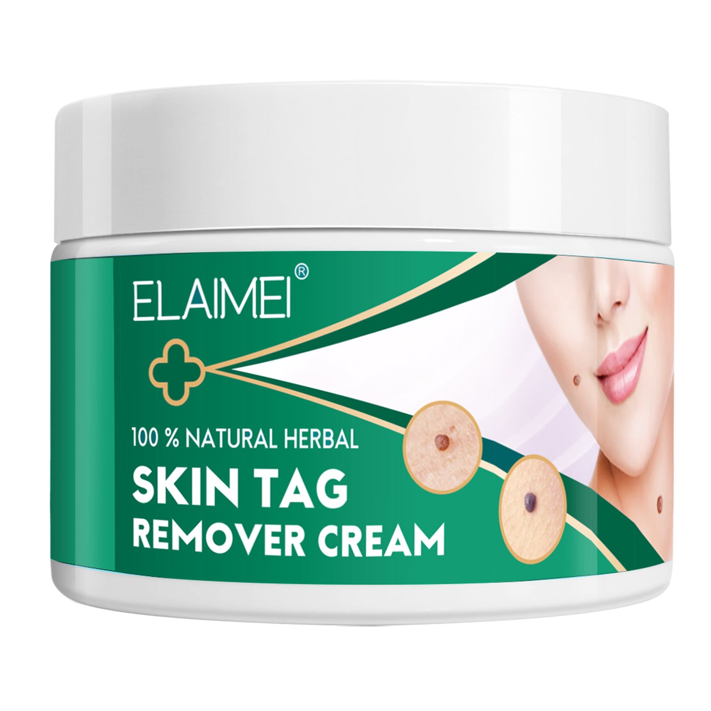 ELAIMEI - 100% Natural Herbal-Skin Tag Remover Cream-Safe-Painless and Reliable