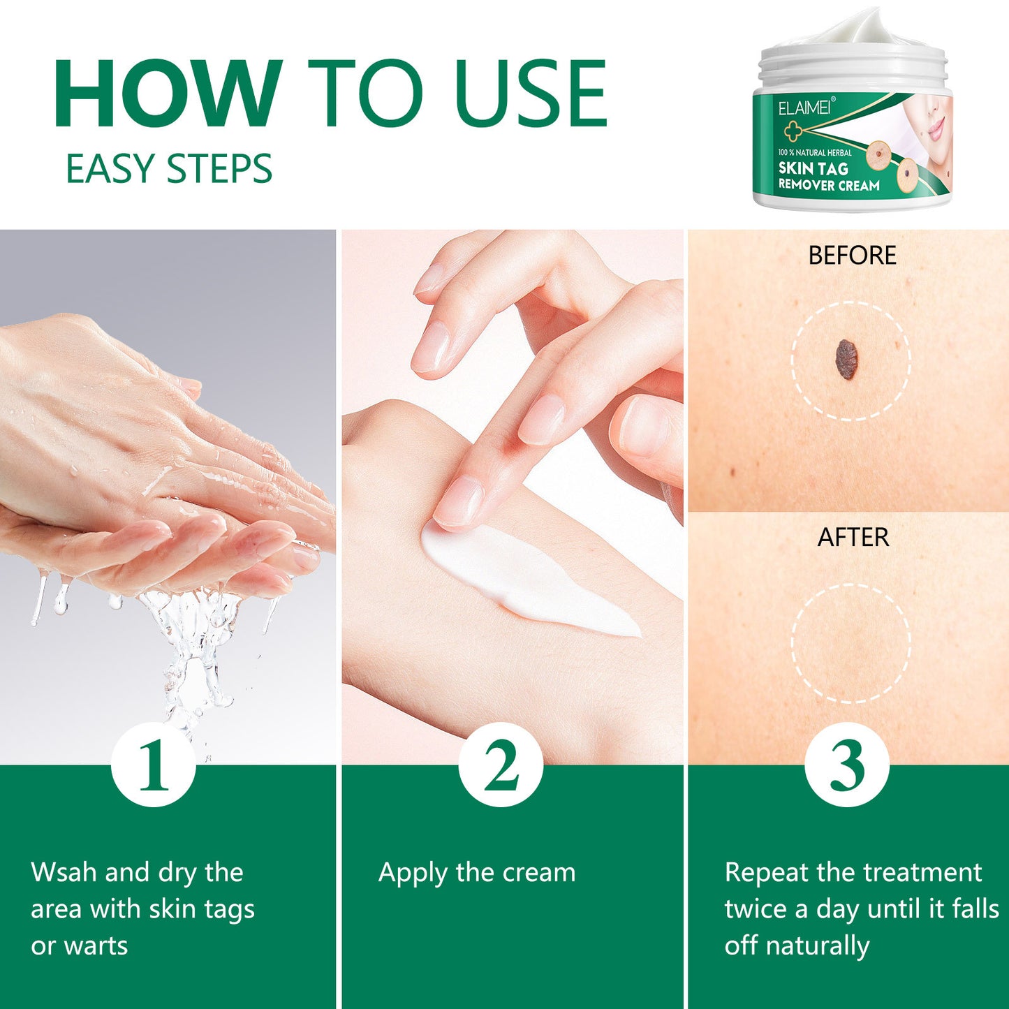 ELAIMEI - 100% Natural Herbal-Skin Tag Remover Cream-Safe-Painless and Reliable